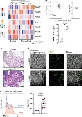 P2x7 Receptor Signaling Blockade Reduces Lung Inflammation and Necrosis During Severe Experimental Tuberculosis